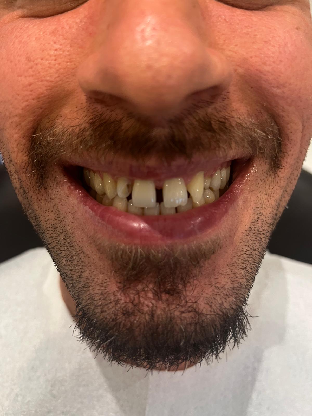 ECE Dental Patient Transformation